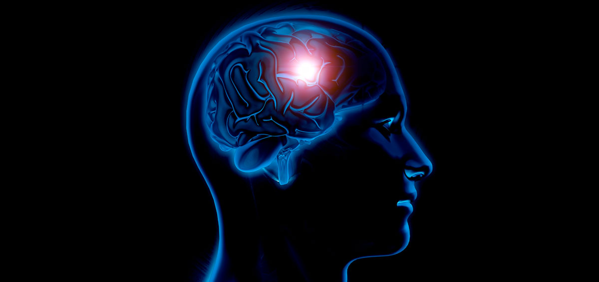 Tumores Cerebral Tumores Cerebral